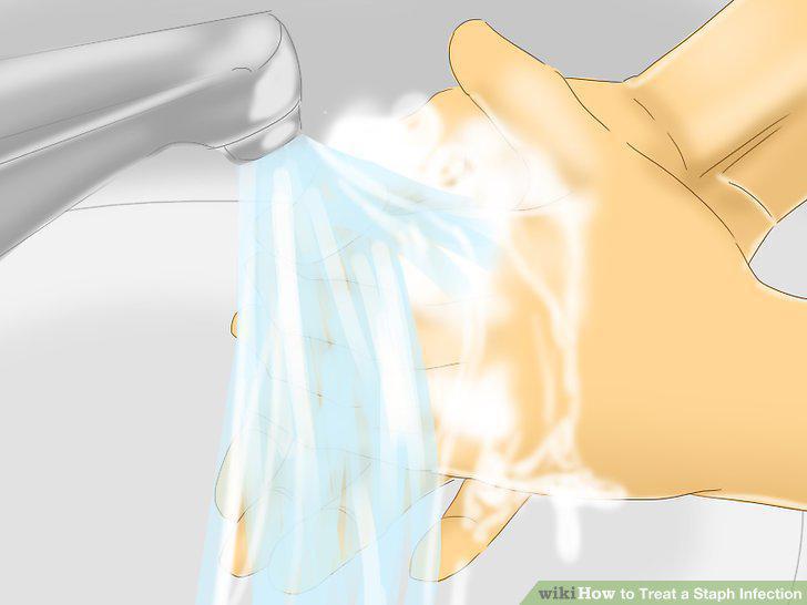 Step 9