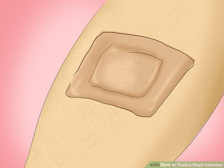 Step 10