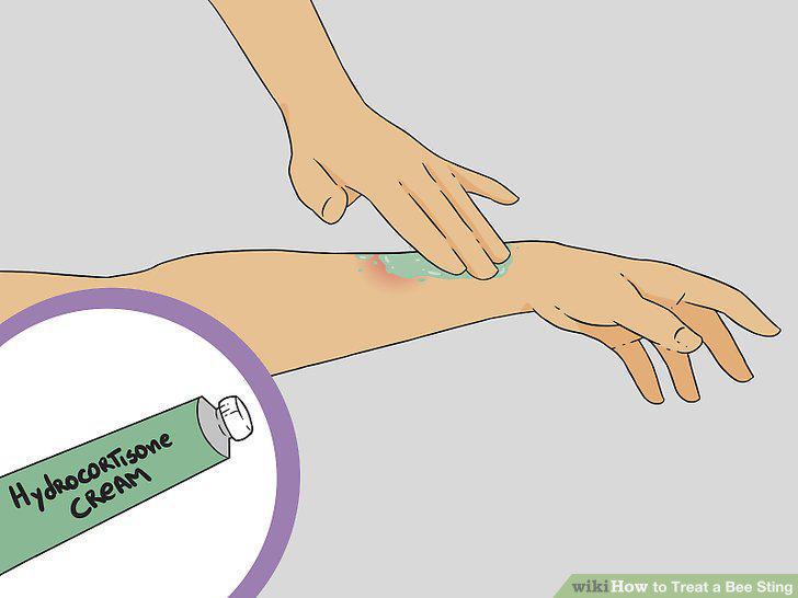 Step 12