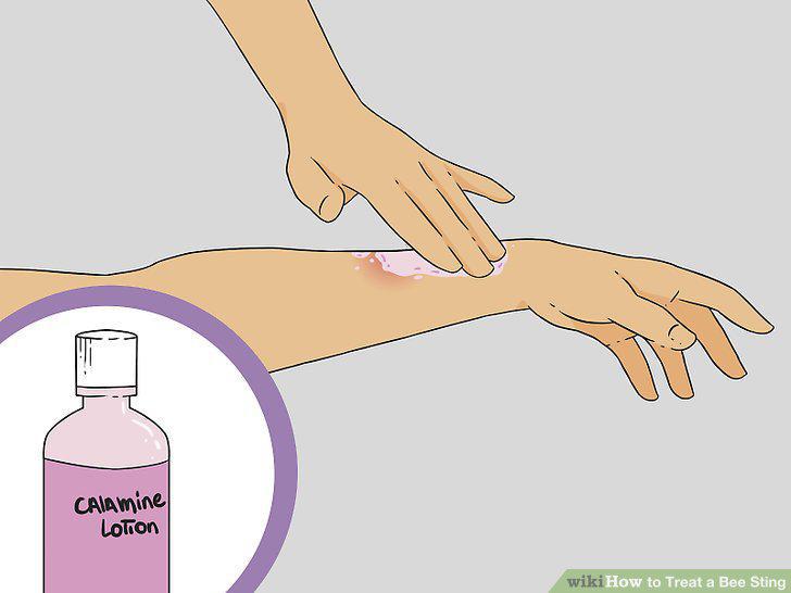 Step 13