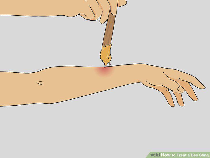 Step 8