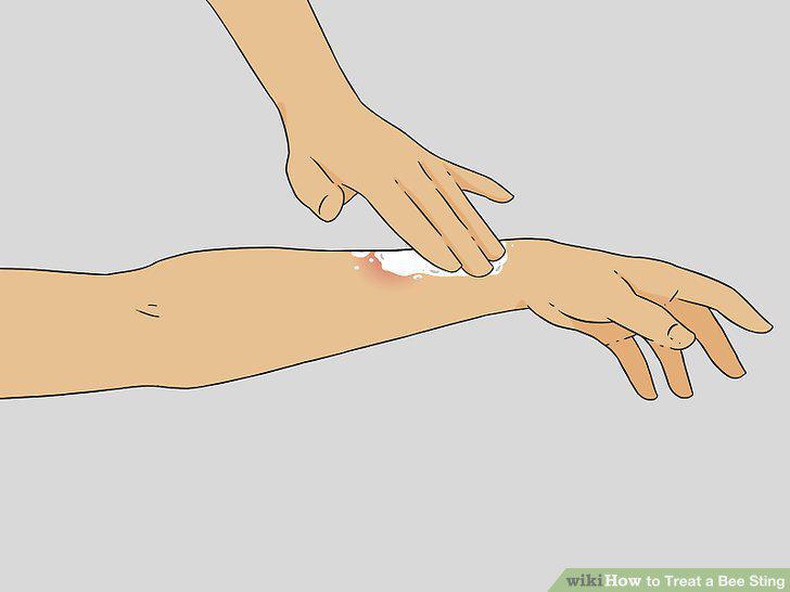 Step 9