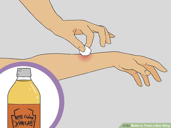 Step 10