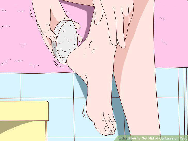 Step 2