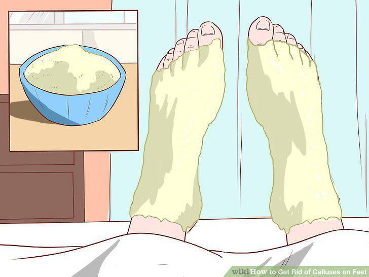 Step 15