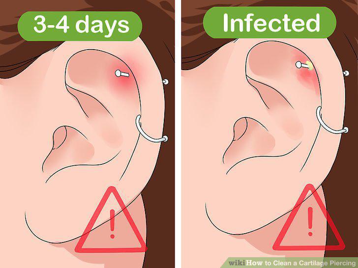 Step 8