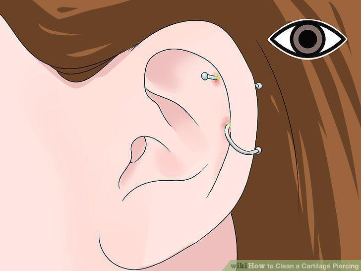 Step 9