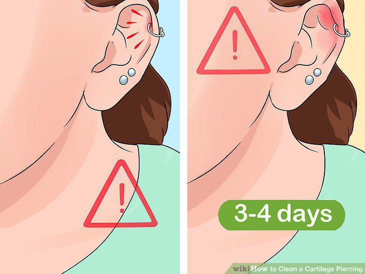 Step 10