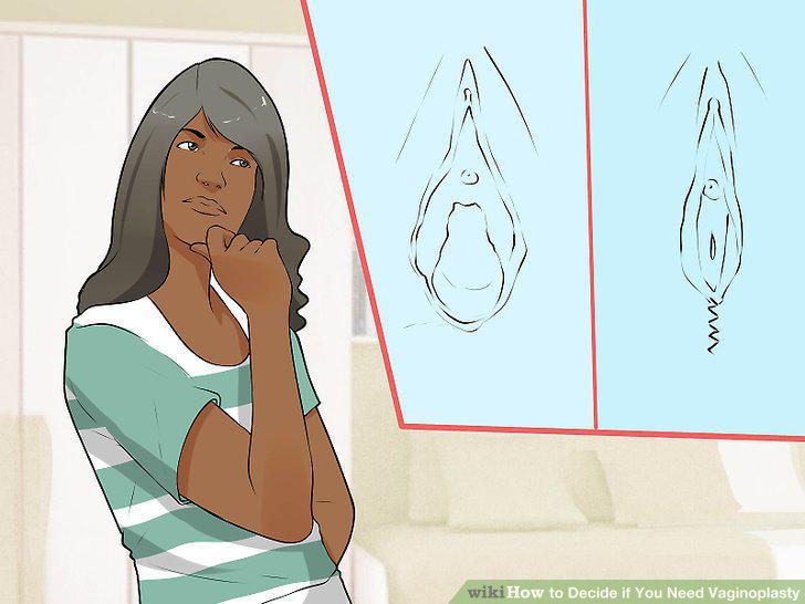 Step 14
