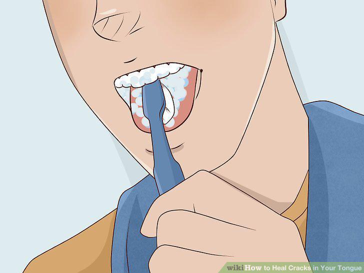 Step 2