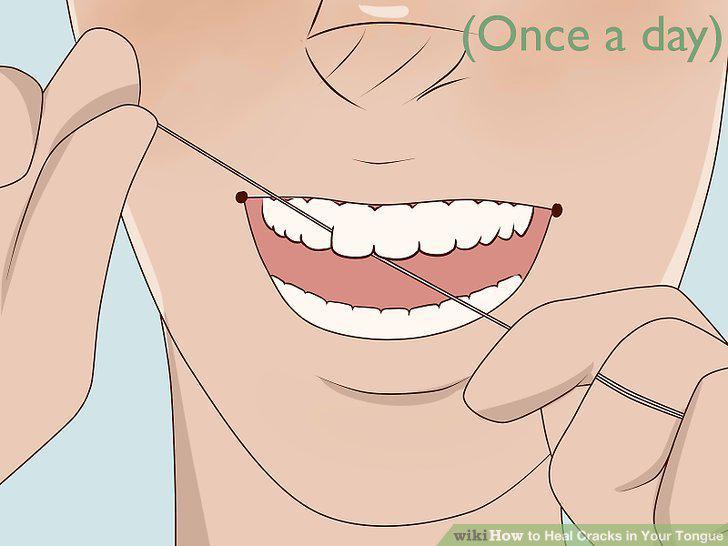 Step 3
