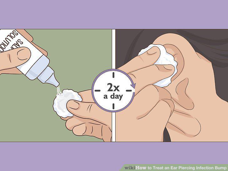 Step 11