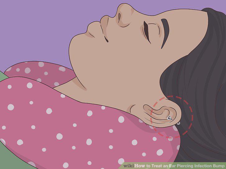 Step 12