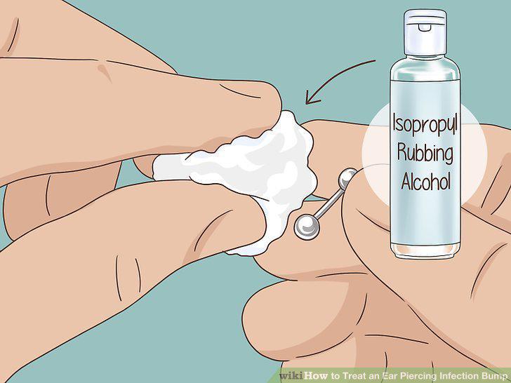 Step 13
