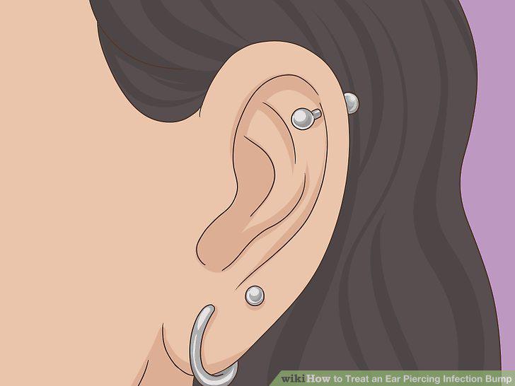 Step 14