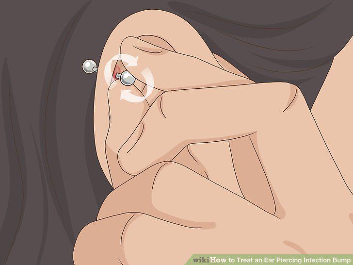 Step 4