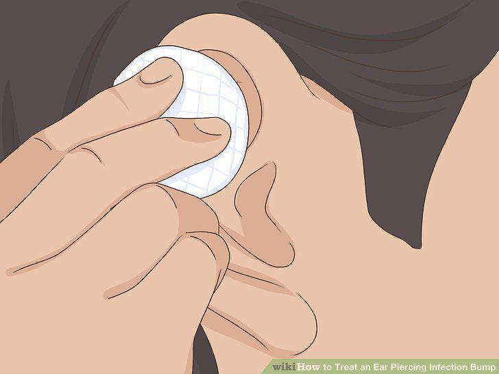 Step 5