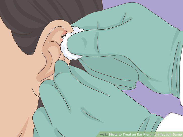 Step 8
