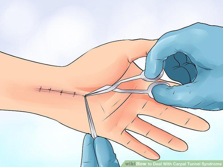 Step 11