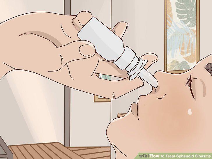 Step 10