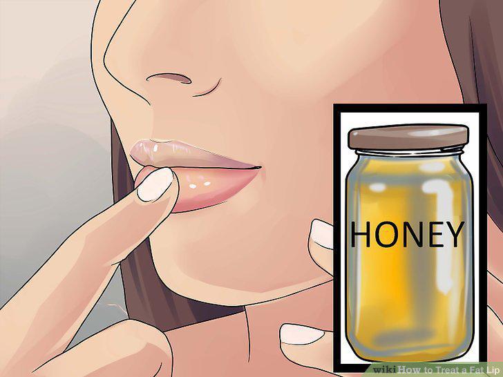 Step 10