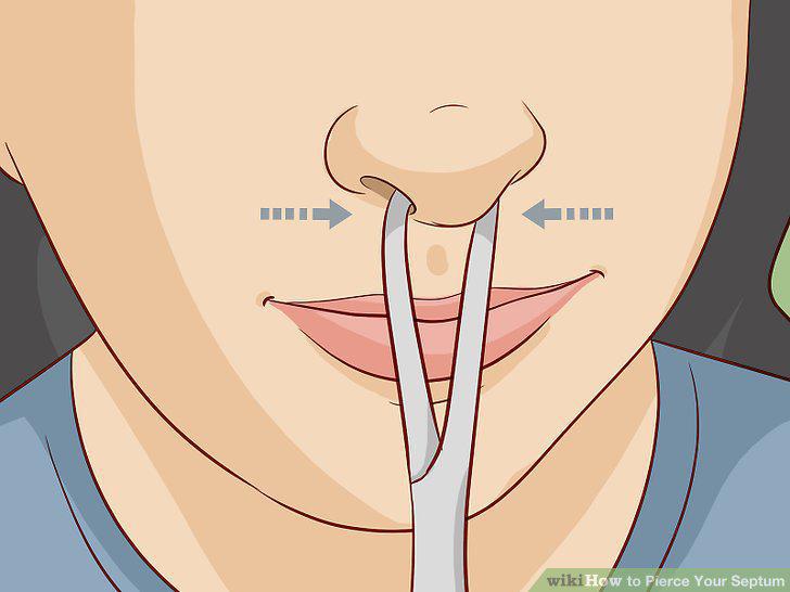 Step 10
