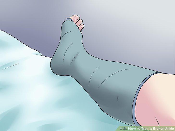 Step 14