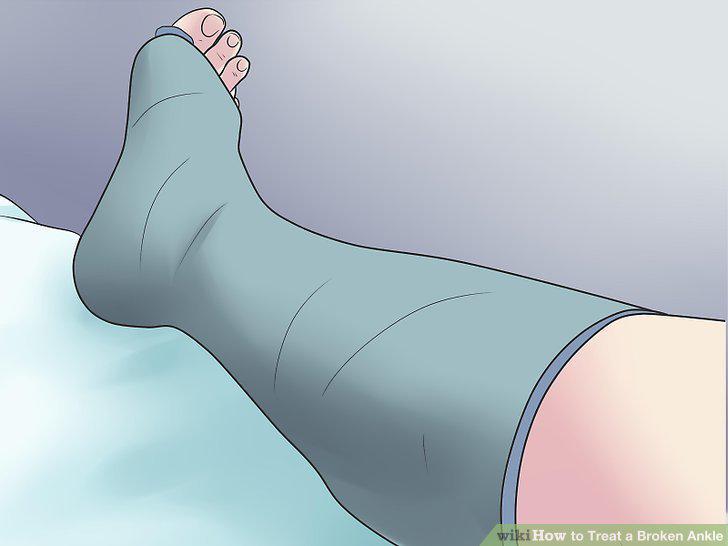 Step 22