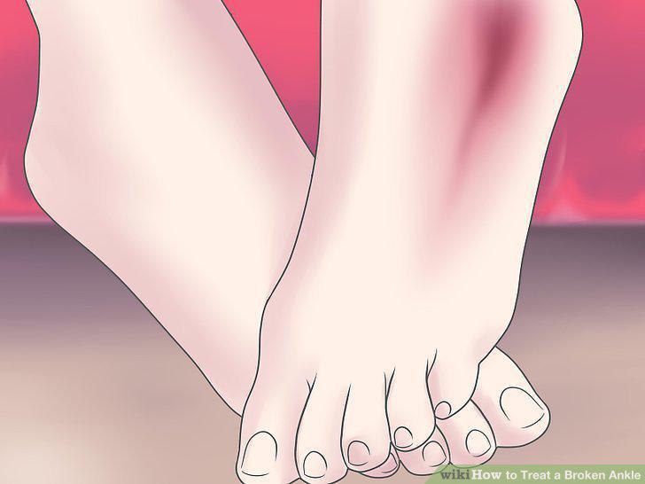 Step 4