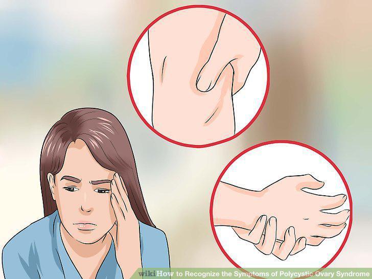 Step 18