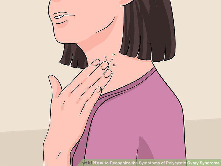 Step 9