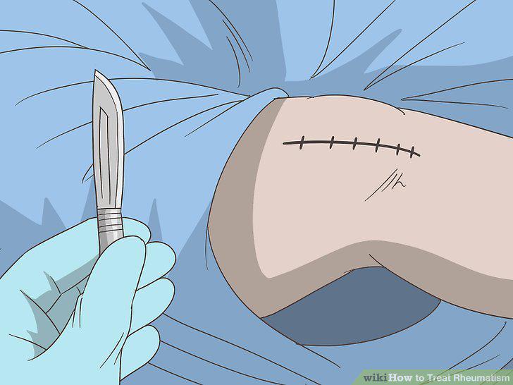 Step 7