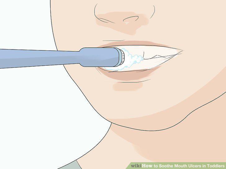 Step 8