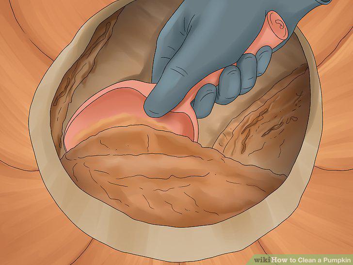Step 10