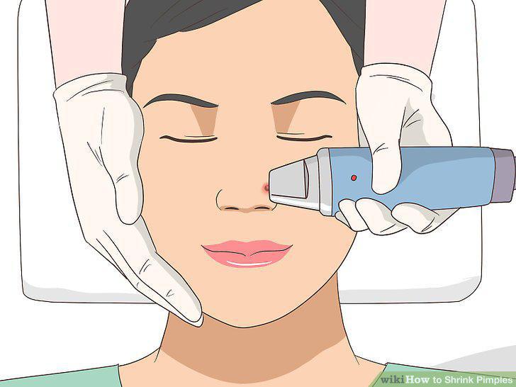 Step 13