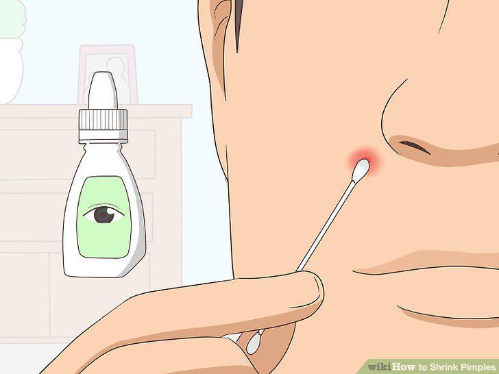 Step 9