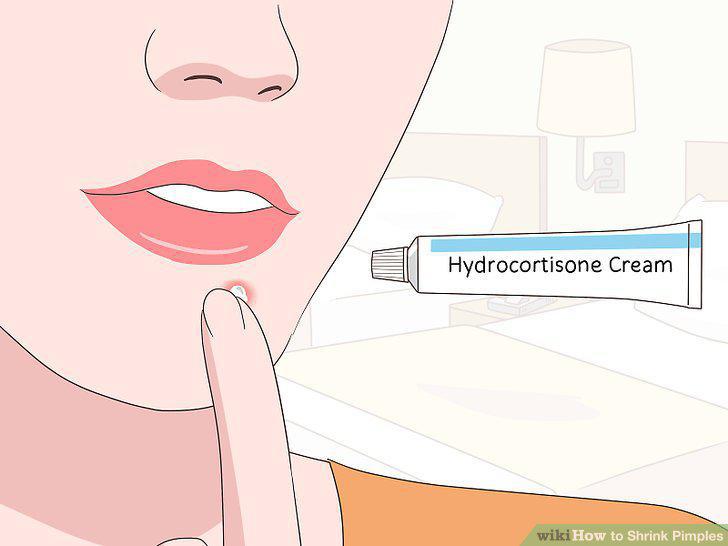 Step 10