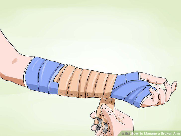 Step 11