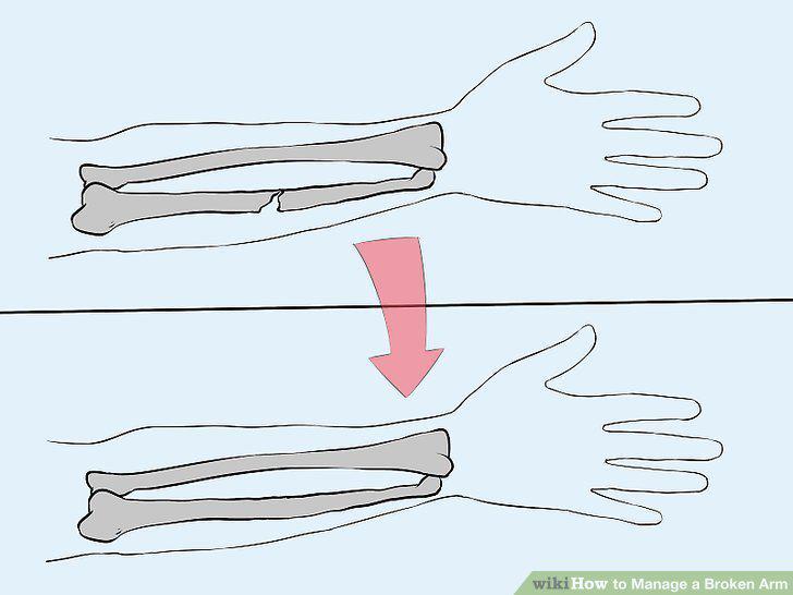 Step 20