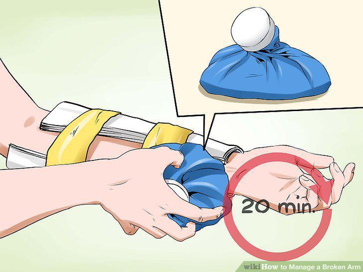 Step 5
