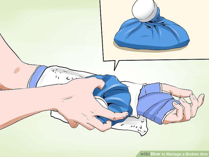 Step 10