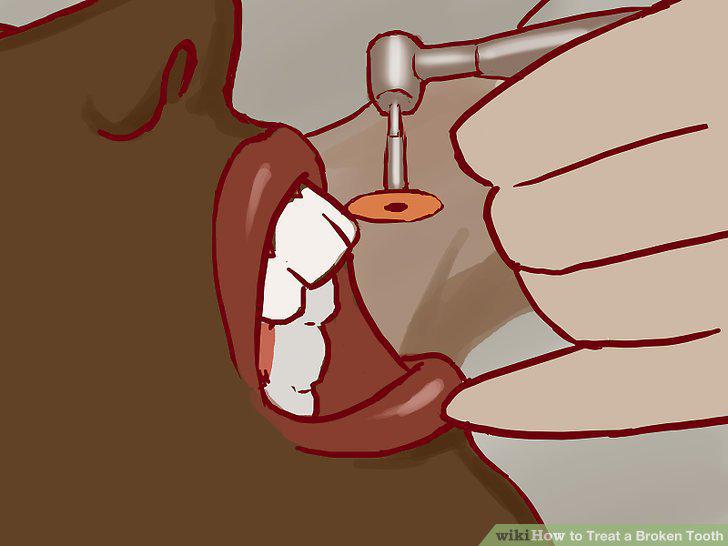 Step 11