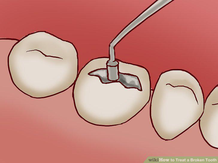 Step 12