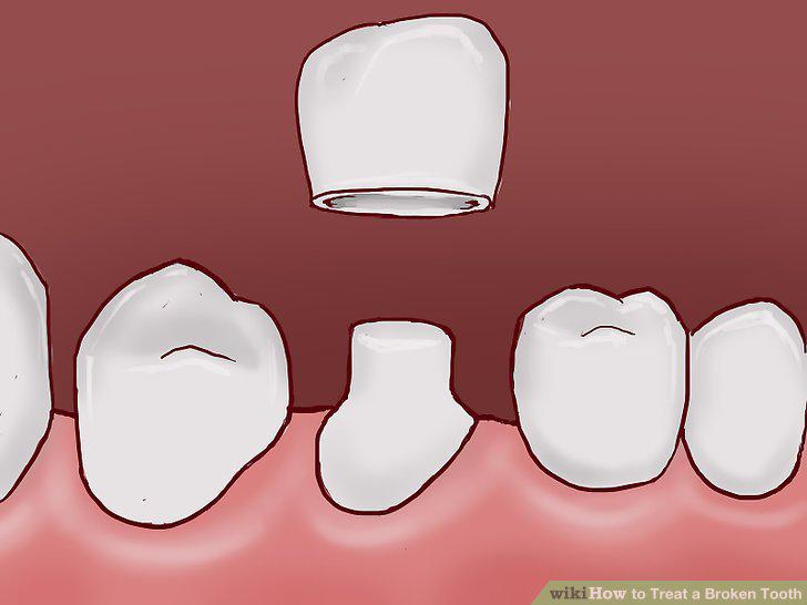 Step 13