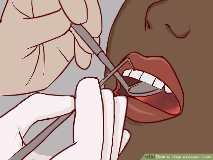 Step 15
