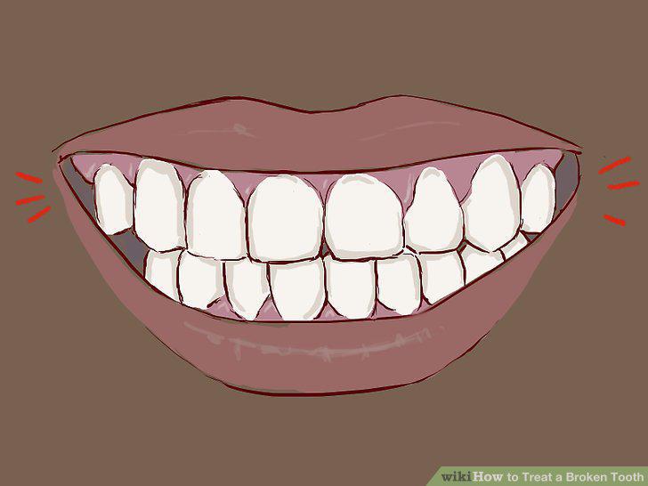 Step 17