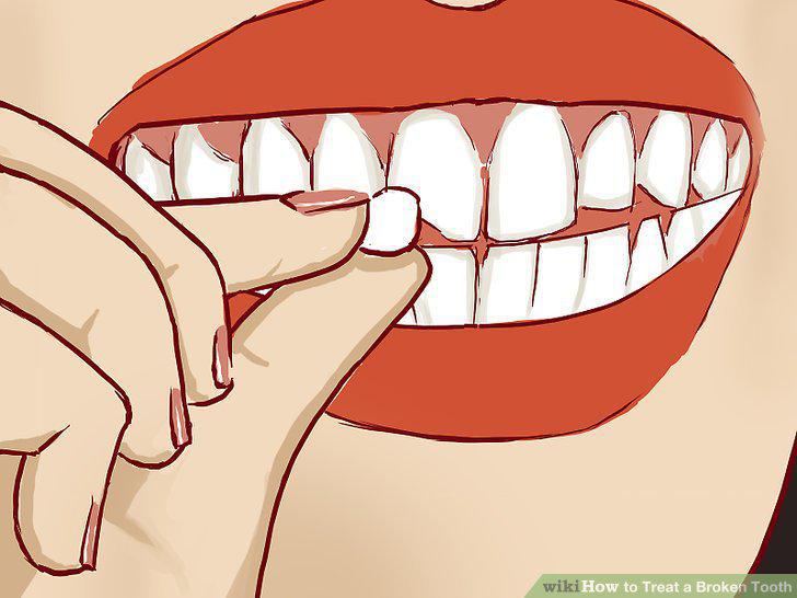 Step 9