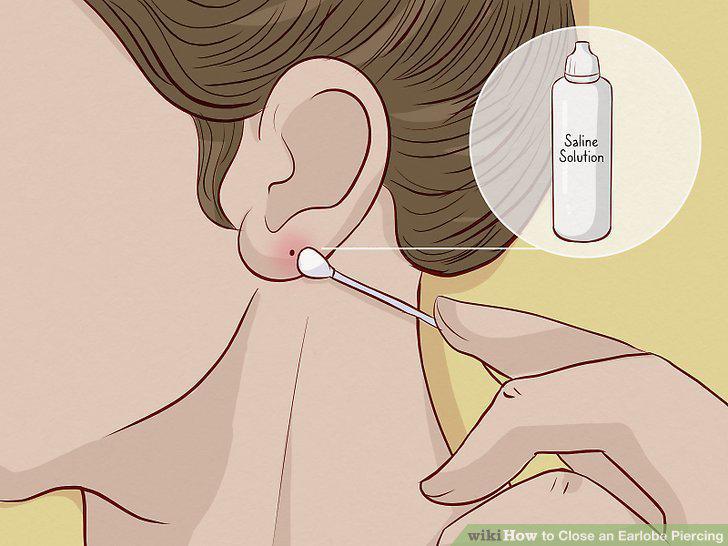Step 2