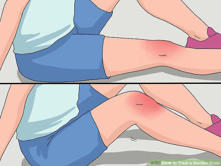 Step 2