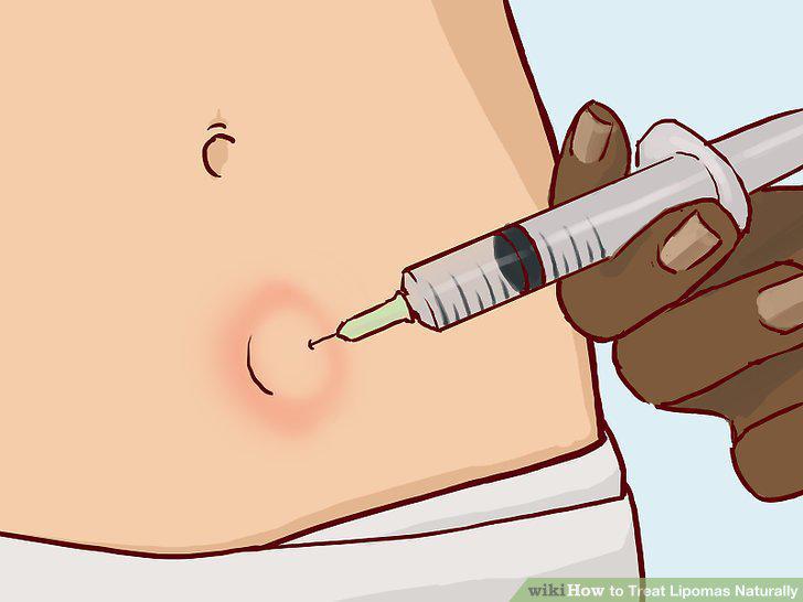Step 11